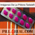 Imágenes De La Píldora Tadalafil 09